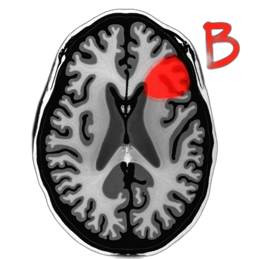 crown, face, red, grayscale, image, brain, scan, marker transparent PNG cut-out