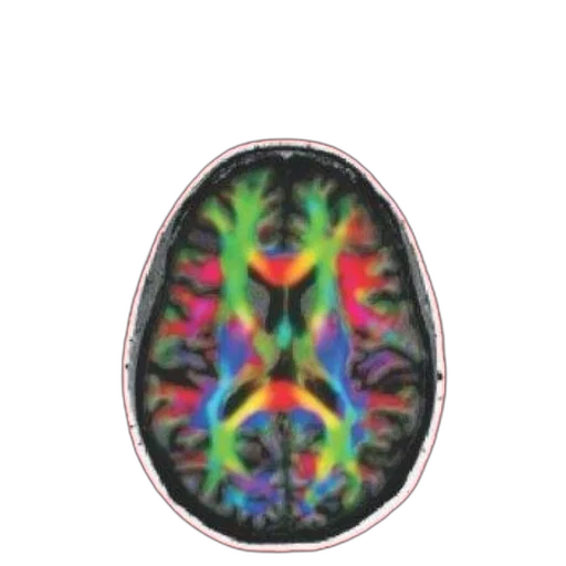 crown, face, cover, book, titled, clinical, psychopharmacology, features transparent PNG cut-out