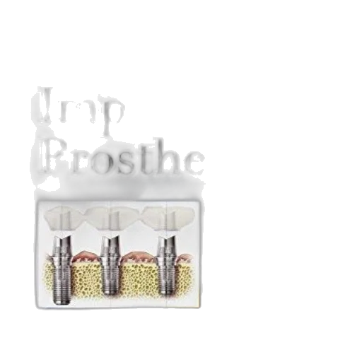 jewelry, furniture, cover, dental, implant, prosthetics, 2nd, edition transparent PNG cut-out