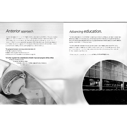 image, features, two, sections, titled, anterior, approach, advancing transparent PNG cut-out