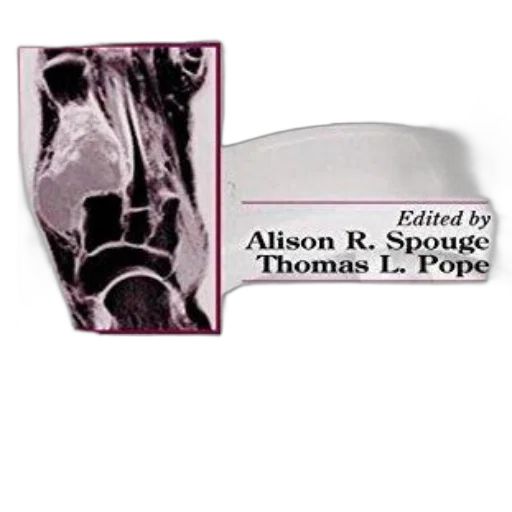 shoes, mask, weapon, book, cover, title, edited, alison transparent PNG cut-out