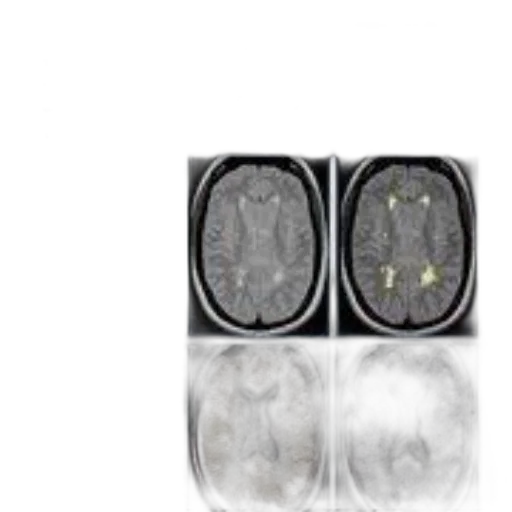 crown, multiple, sclerosis, therapeutics, fourth, edition, book, cover transparent PNG cut-out