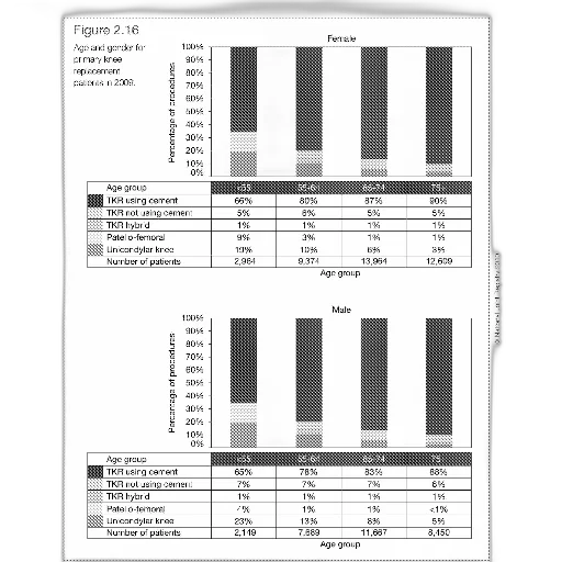 bar, graph, showing, percentage, knee, replacement, patients, age transparent PNG cut-out