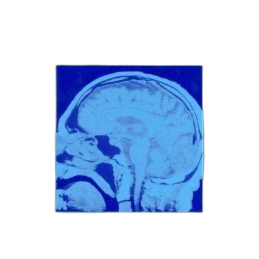 crown, face, robot, blue, cover, treatment, algorithms, psychopharmacology transparent PNG cut-out