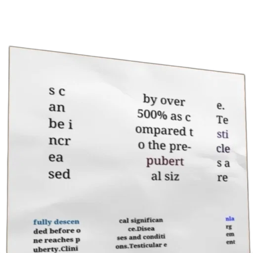 furniture, outer space, text-based, image, discussing, increase, testicle, size transparent PNG cut-out