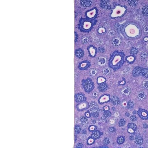 different, pathology, images, two, same, microscope transparent PNG cut-out